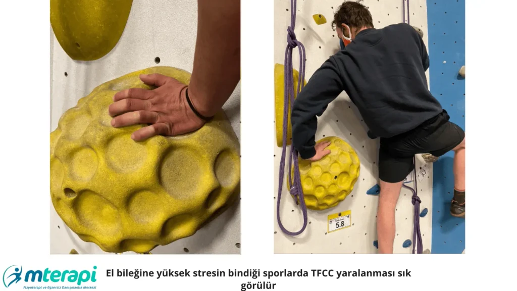 tfcc yırtığı tedavisi