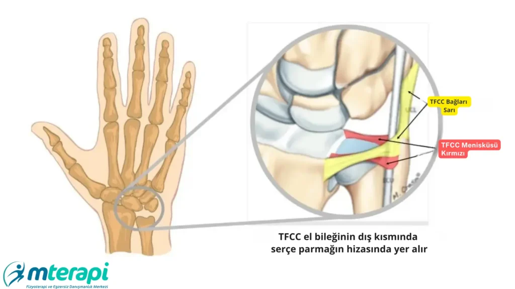 tfcc yırtığı