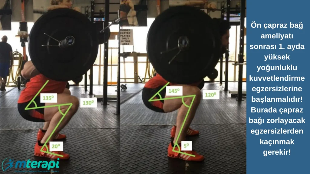 Ön Çapraz Bağ Ameliyatı Sonrası Spora Dönüş ön çapraz bağ egzersizleri