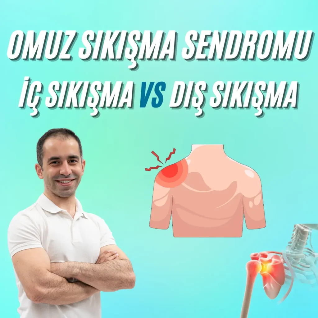 Omuz Sıkışma Sendromu - Tedavisi Nasıl Olur? omuz sıkışma sendromu