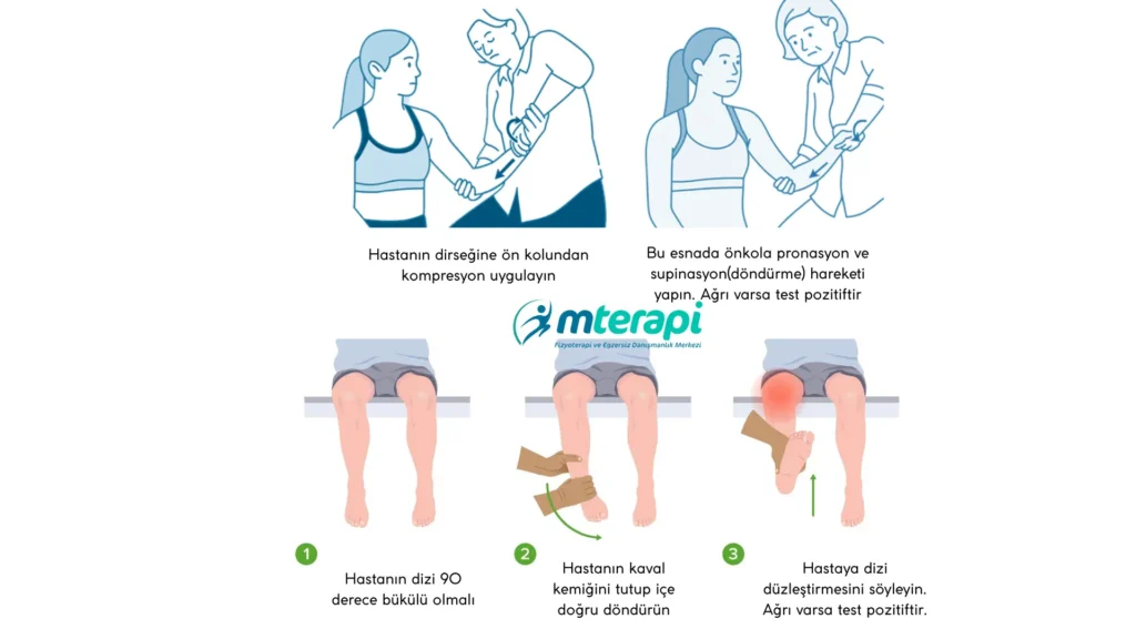 osteokondritis dissekans testleri belirtileri