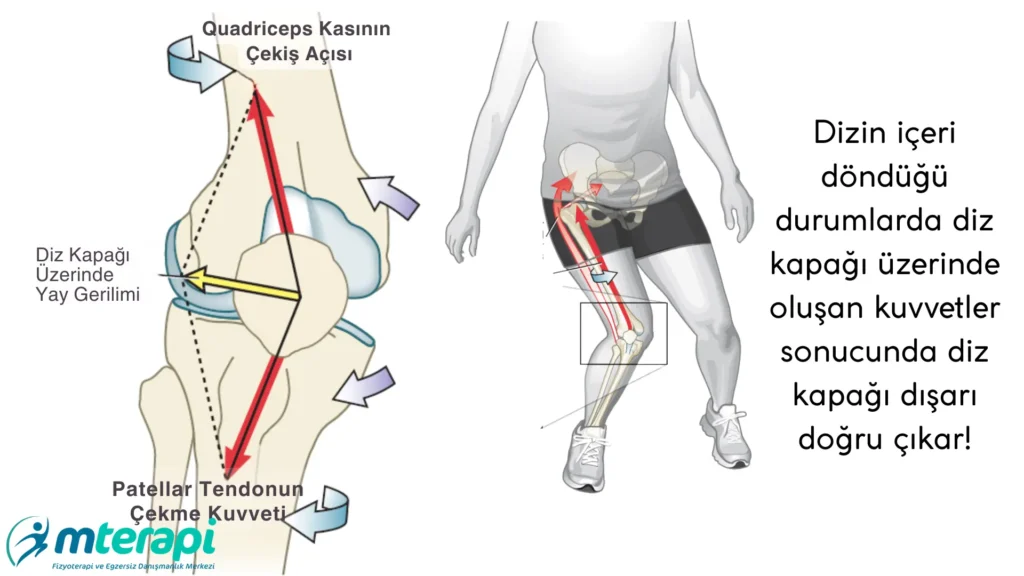 diz kapağı çıkması nasıl olur