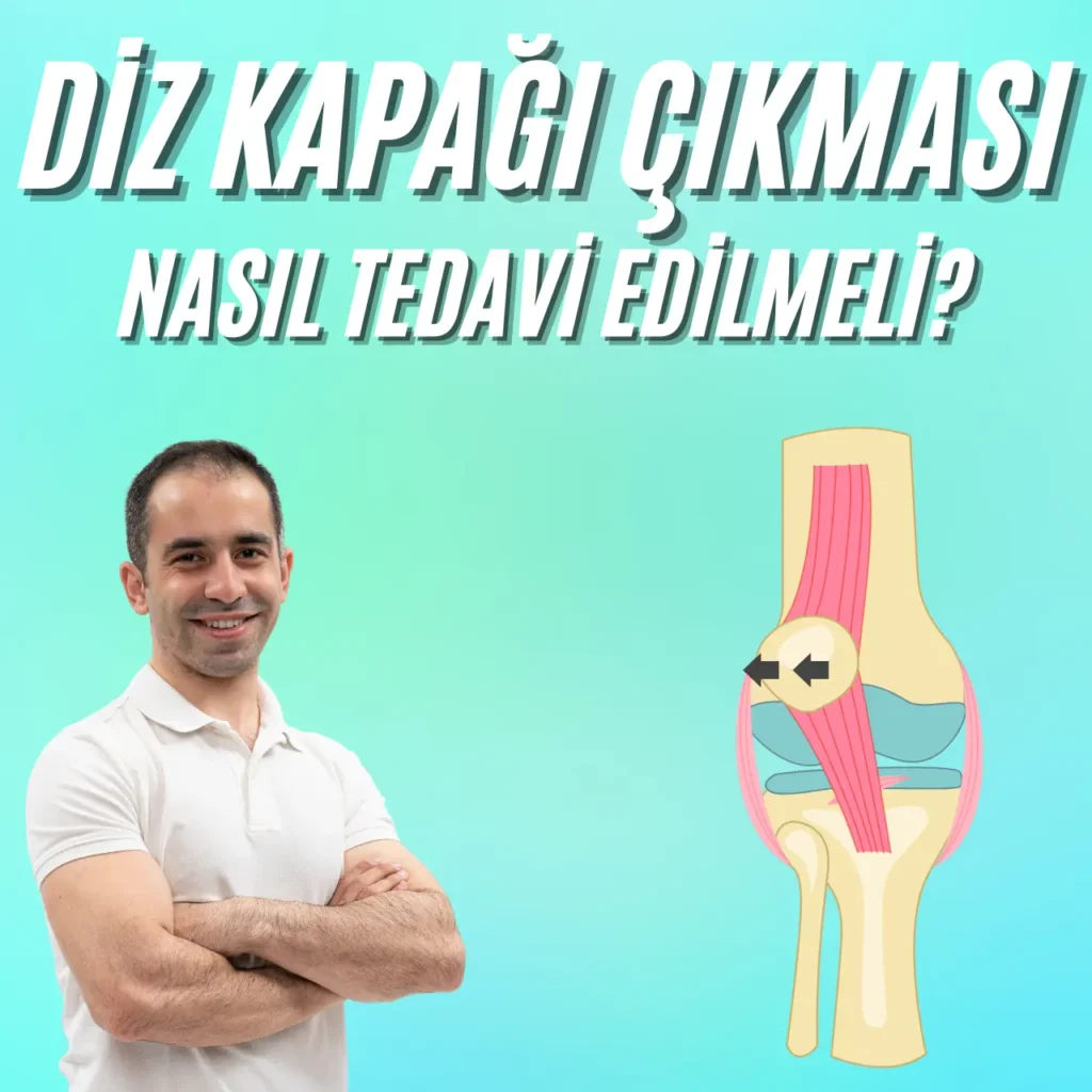 Diz Kapağı Çıkması diz kapağı çıkması