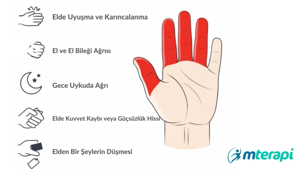 karpal tünel sendromu belirtileri